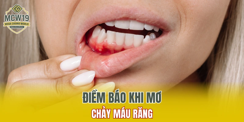 Lô Gan Là Gì? Một Số Điều Phải Biết Khi Chơi Số Lô Gan 7 Điềm báo khi mơ thấy chảy máu răng