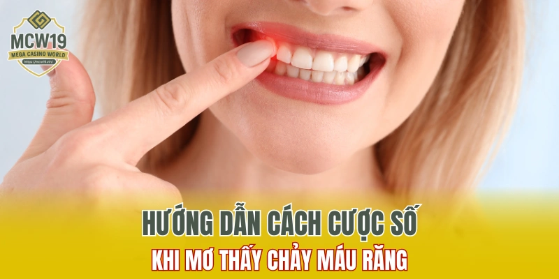 Lô Gan Là Gì? Một Số Điều Phải Biết Khi Chơi Số Lô Gan 9 Hướng dẫn cách cược số tại MCW19 khi mơ thấy chảy máu răng